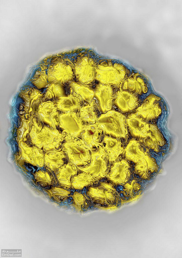 HPV چیست - ویروس پاپیلوم انسانی